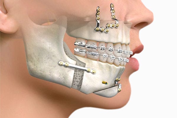 Cirugía Maxilofacial