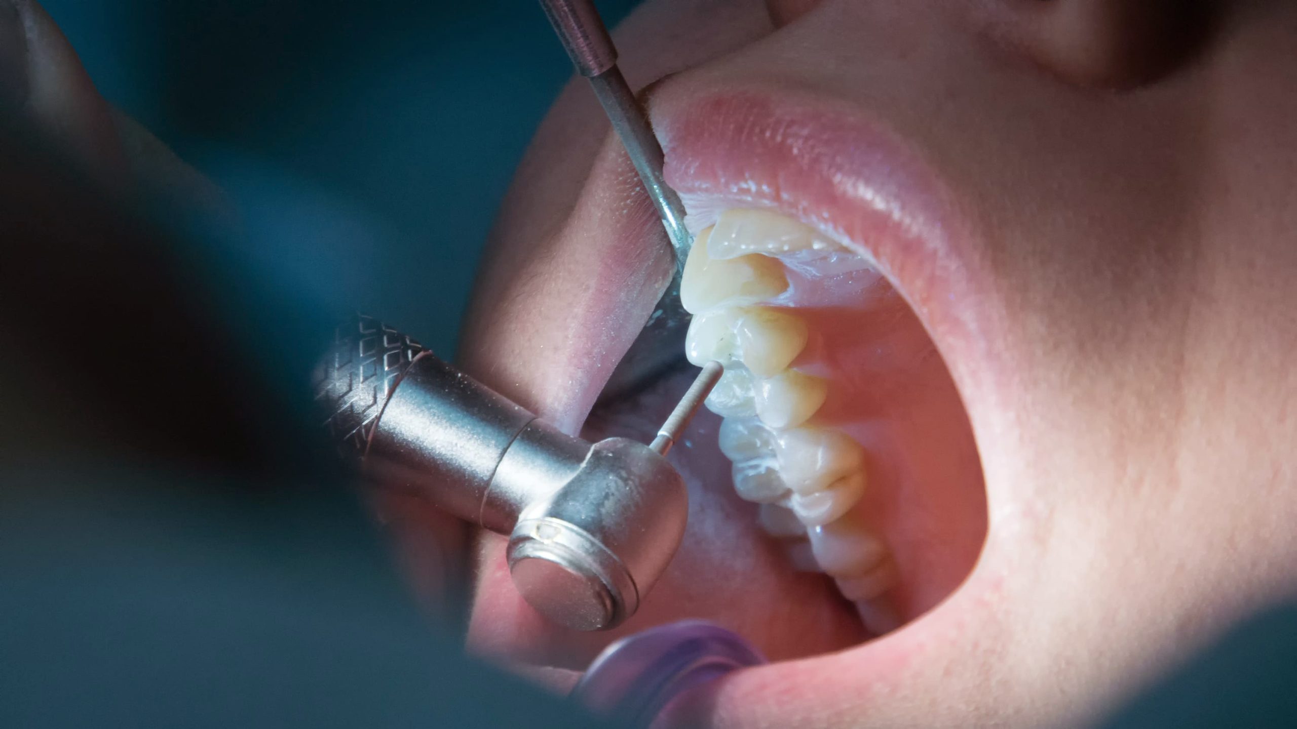 Endodoncia