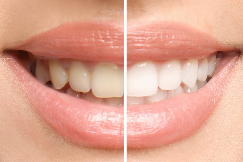 Rehabilitación Oral