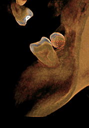 Figura 4