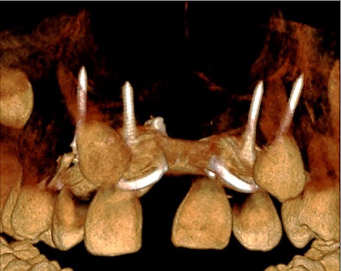 Figura 5