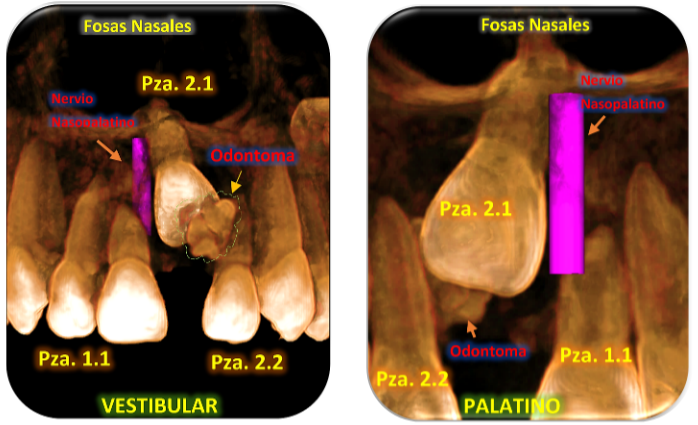 Figura 2.1