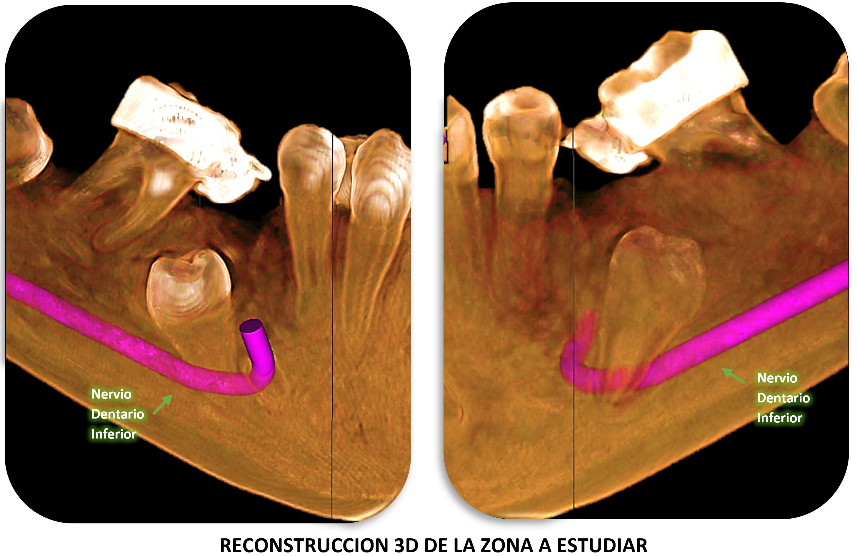 TOMOGRAFIA CONE BEAM