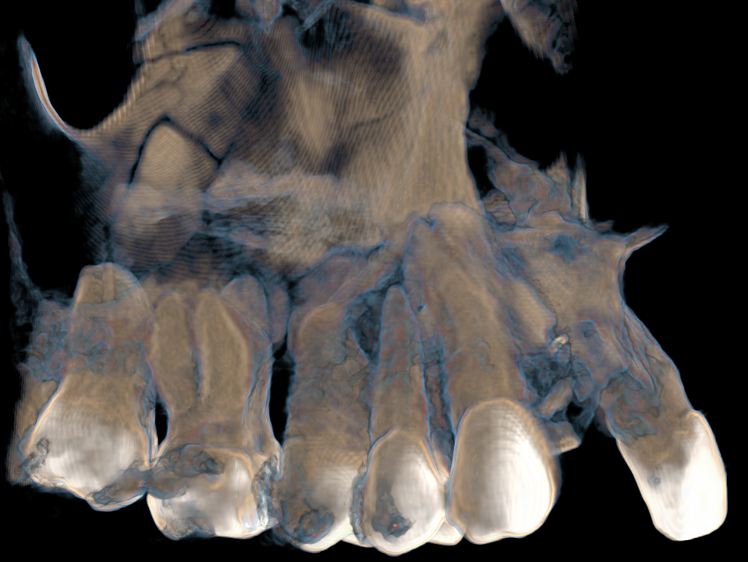 VISTA VOLUMETRICA LATERAL