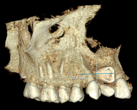 FIGURA 6