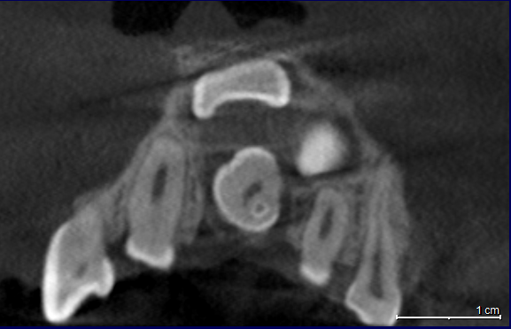 FIGURA 2 