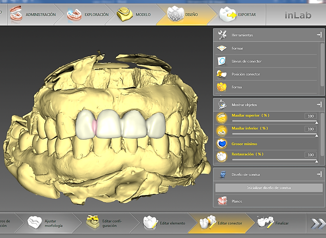 FIGURA 4