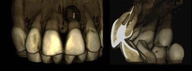 TOMOGRAFÍA CONE BEAM (CBCT)