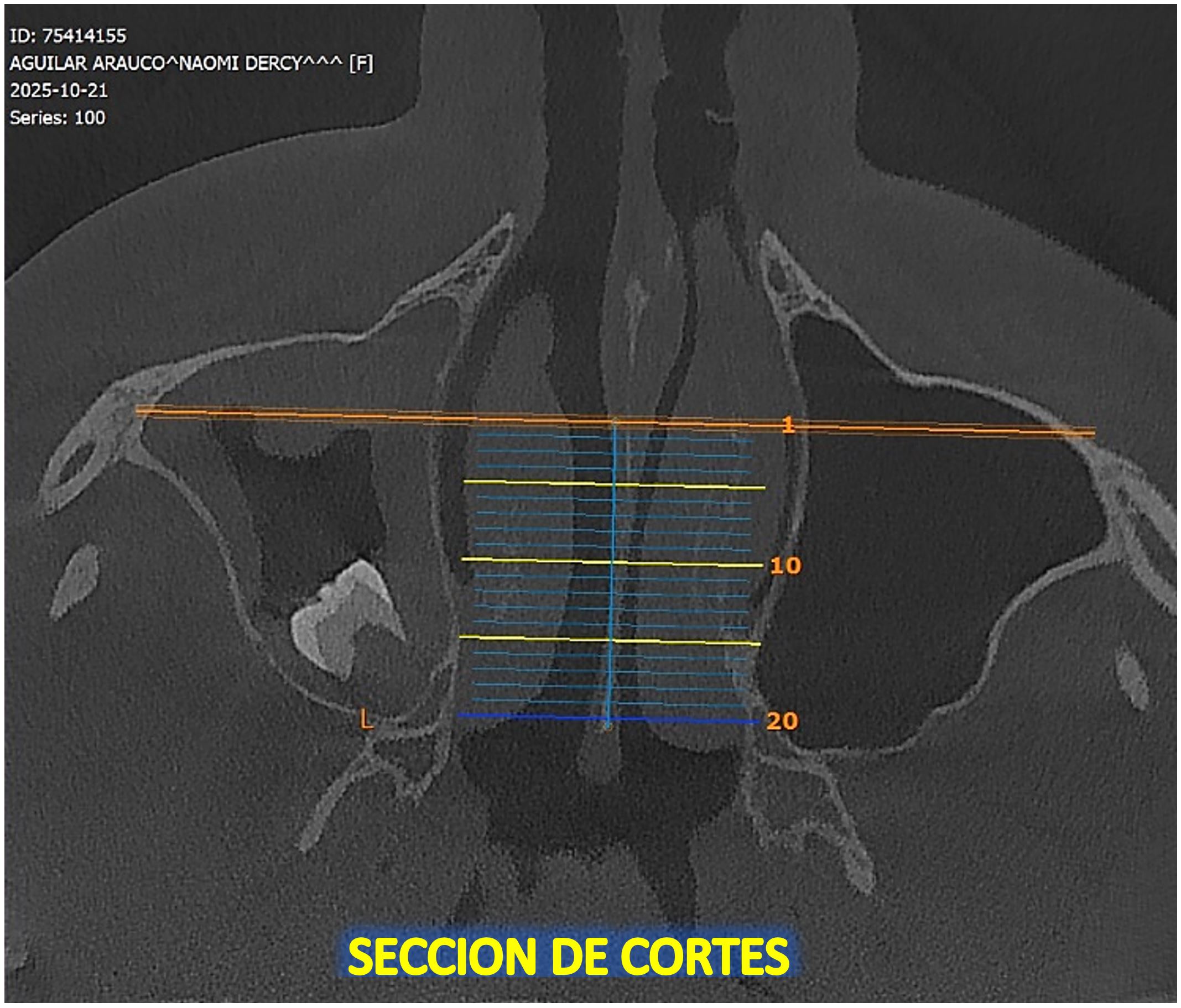 FIGURA 7