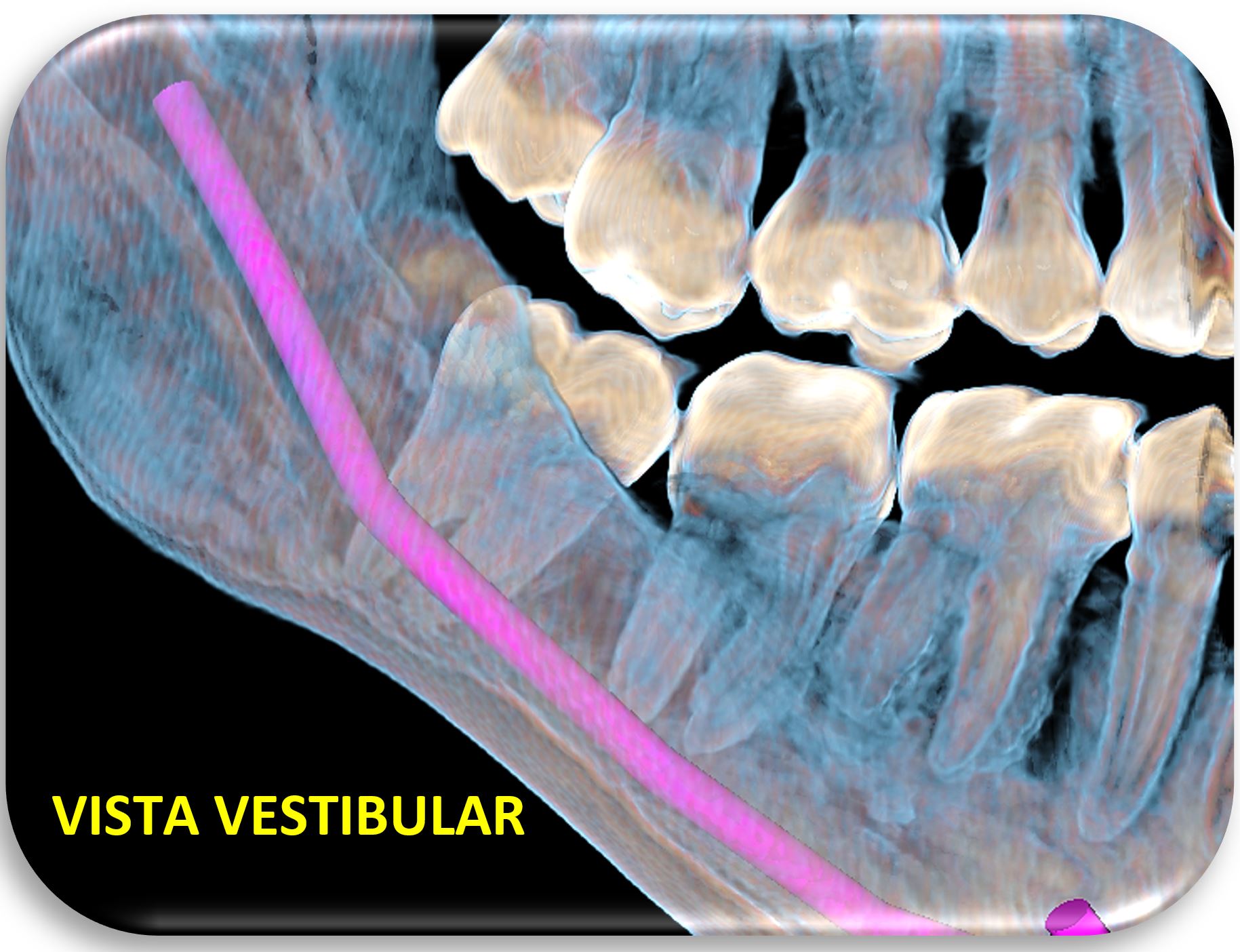 HALLAZGOS IMAGENOLÓGICOS