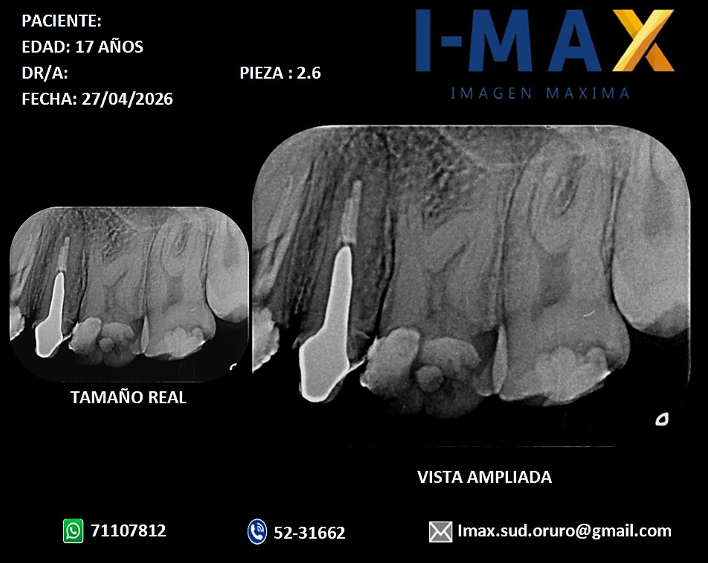 Imagen radiográfica periapical 
