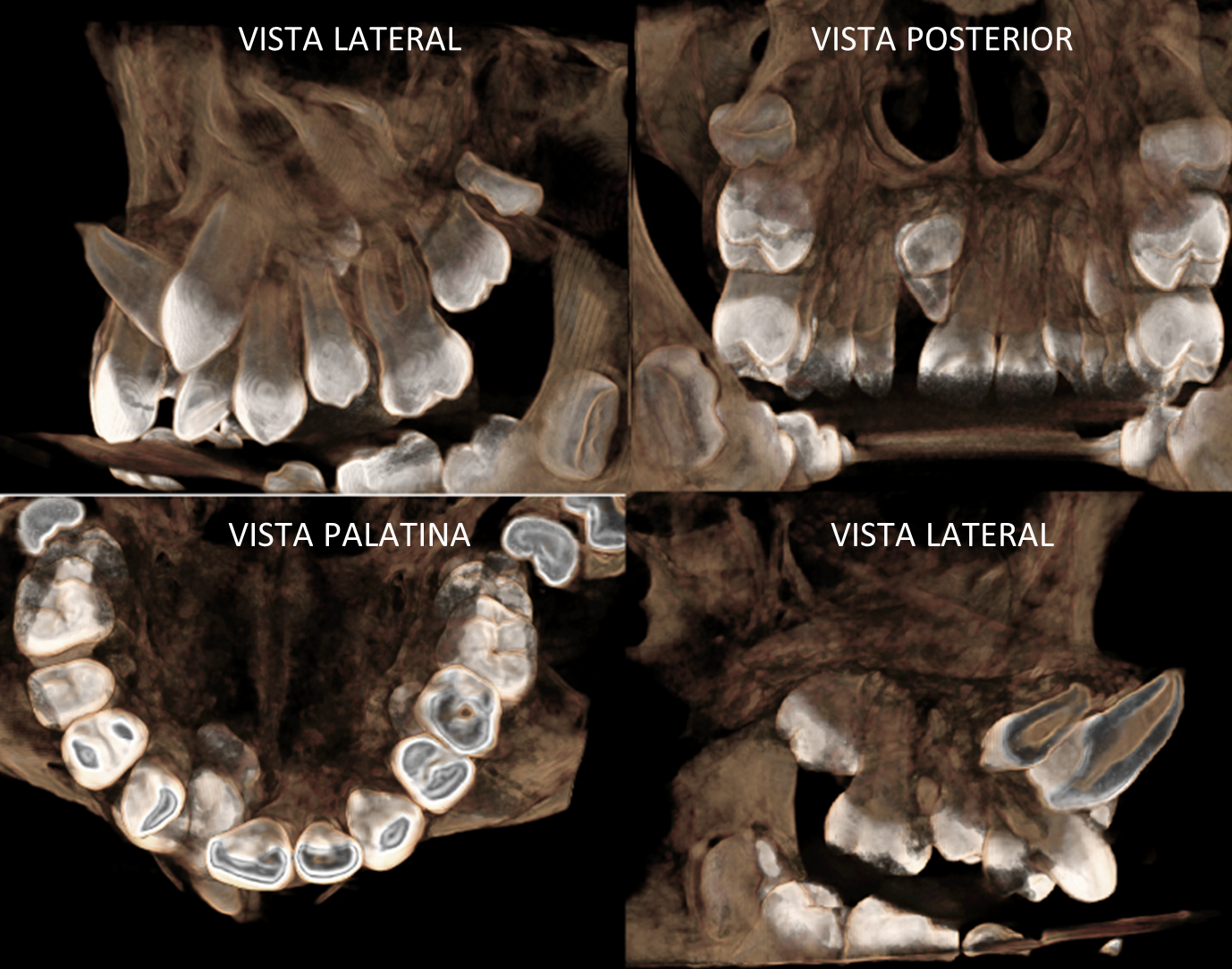 FIGURA 2 
