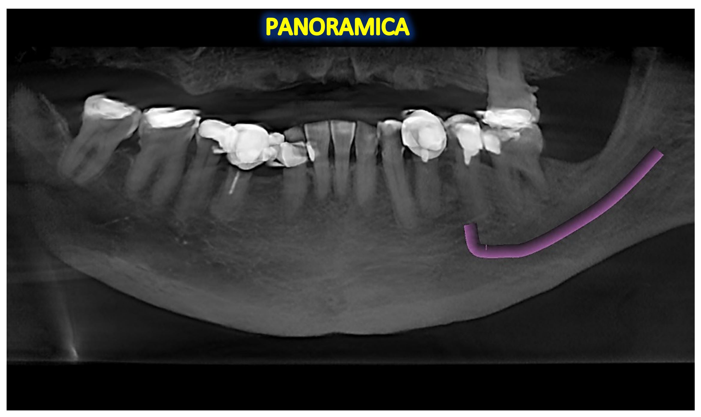 FIGURA 1