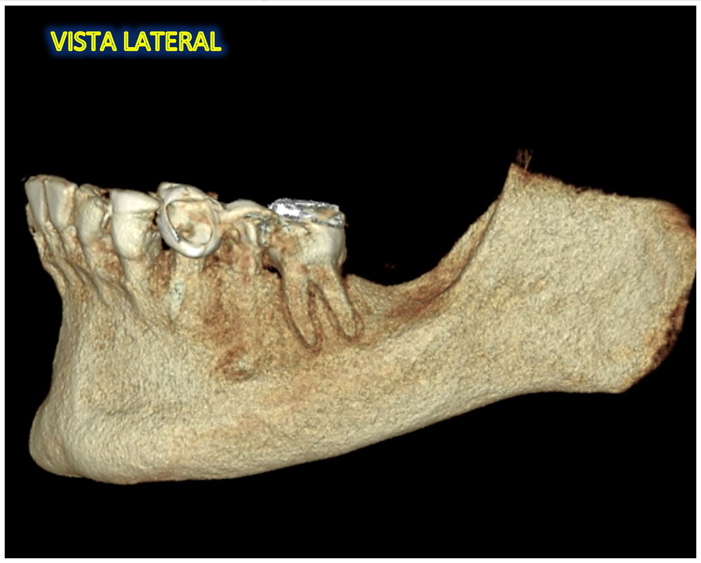 FIGURA 4