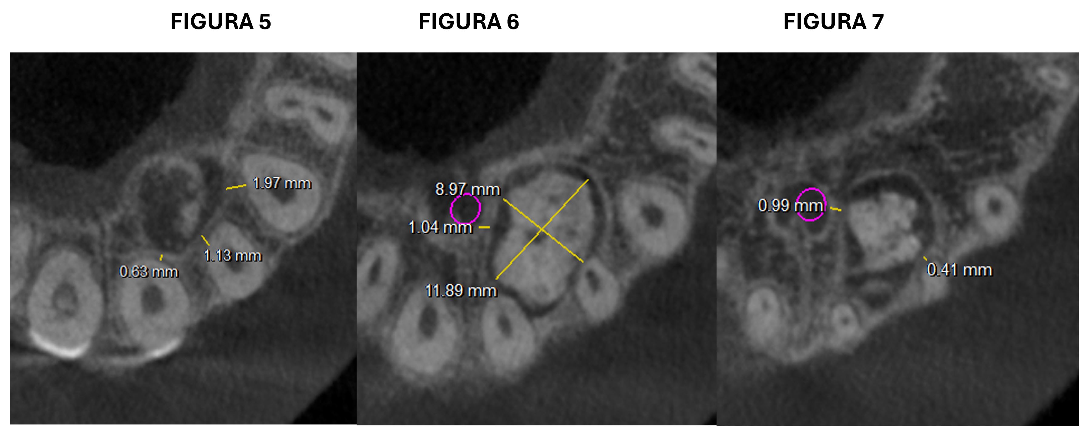 FIGURA 5 - 6 - 7