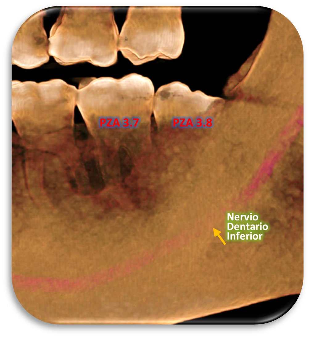 FIGURA 1 Y 2