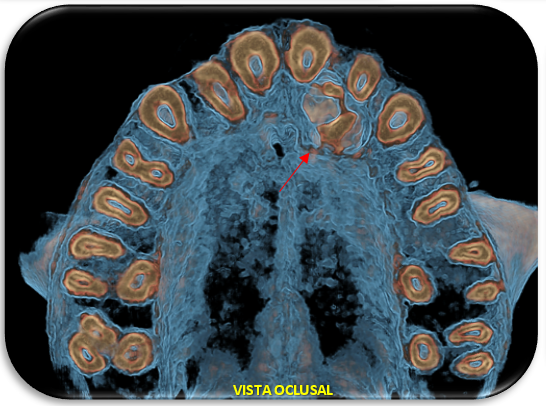 VISTA OCLUSAL