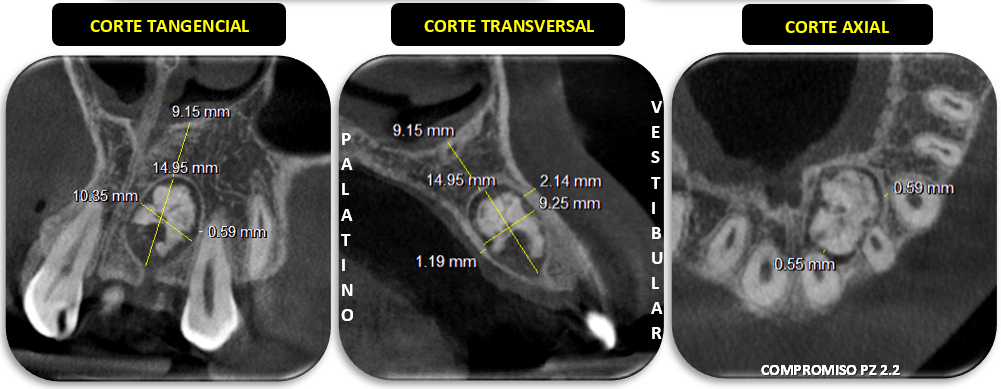 CORTES TRANSVERSALES