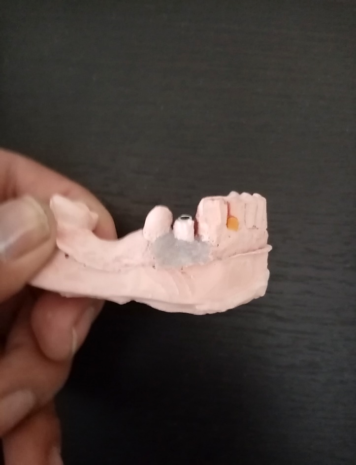FIGURA 2 