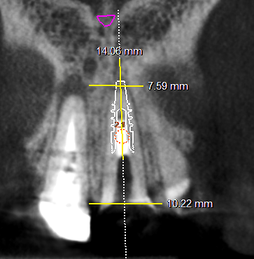 FIGURA 3