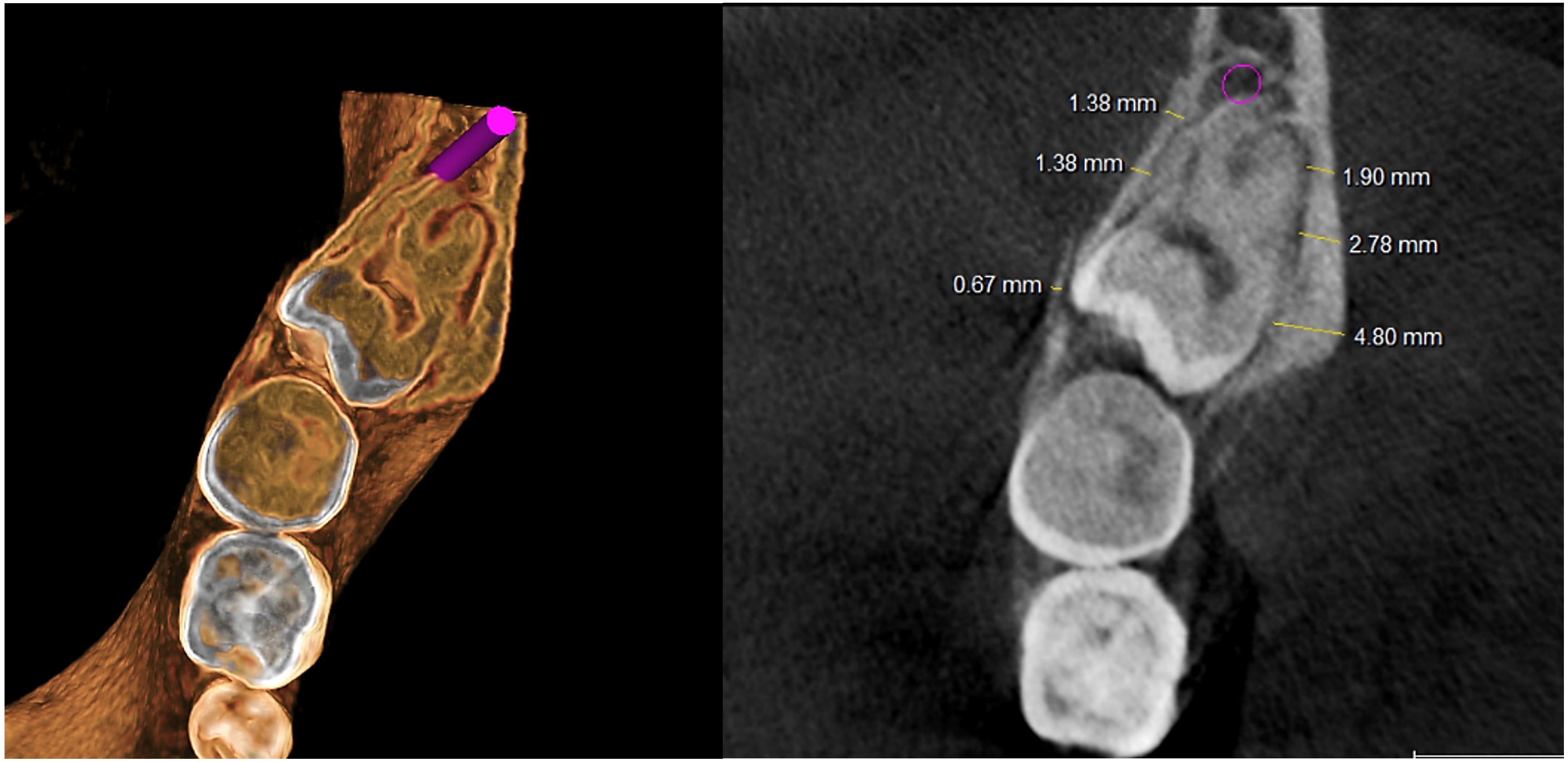 Evaluación tomográfica – Corte axial