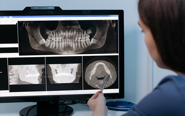 Radiología Digital