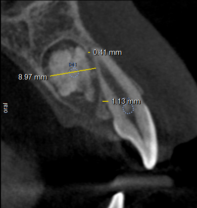 ODONTOMA